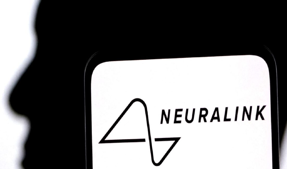 Beyin Çipinin İlk Deneme Sürecinde Yaşanan Beklenmedik Sorunlar Beyin çipinin ilk deneme sürecinde yaşanan beklenmedik sorunlar hakkında bilgi