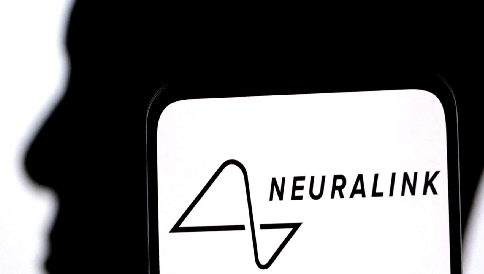 Beyin çipinin ilk deneme sürecinde yaşanan beklenmedik sorunlar hakkında bilgi