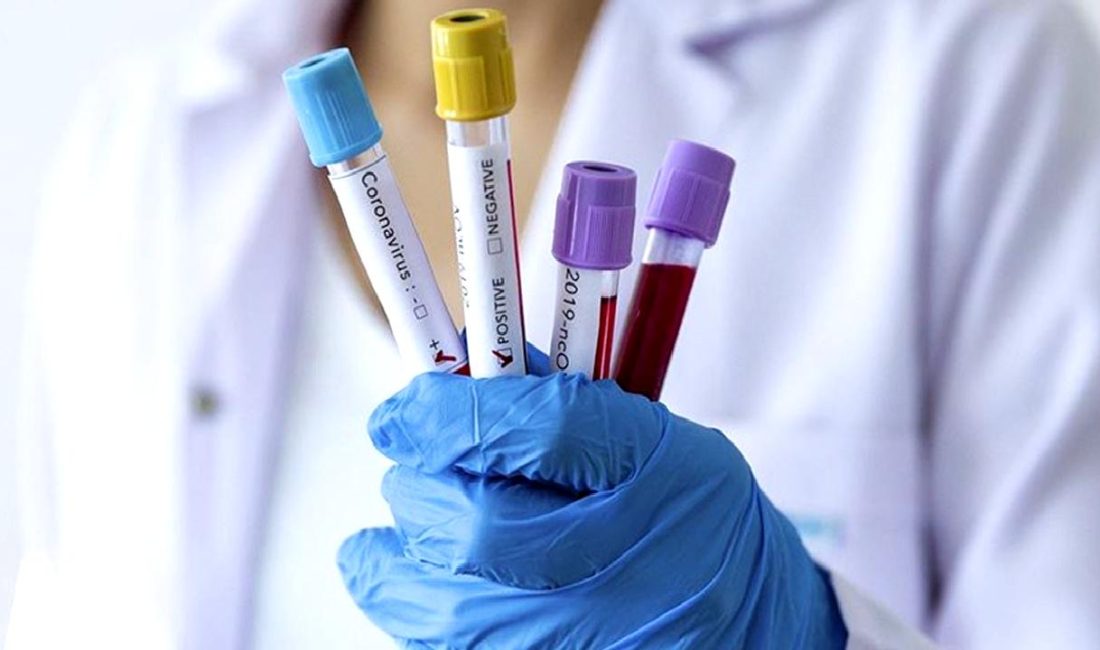 Virolog Cang Yongcın ve Covid-19 DNA Dizilimi Çalışmaları Virolog Cang Yongcın'ın öncülük ettiği Covid-19 DNA dizilimi çalışmalarını keşfedin.