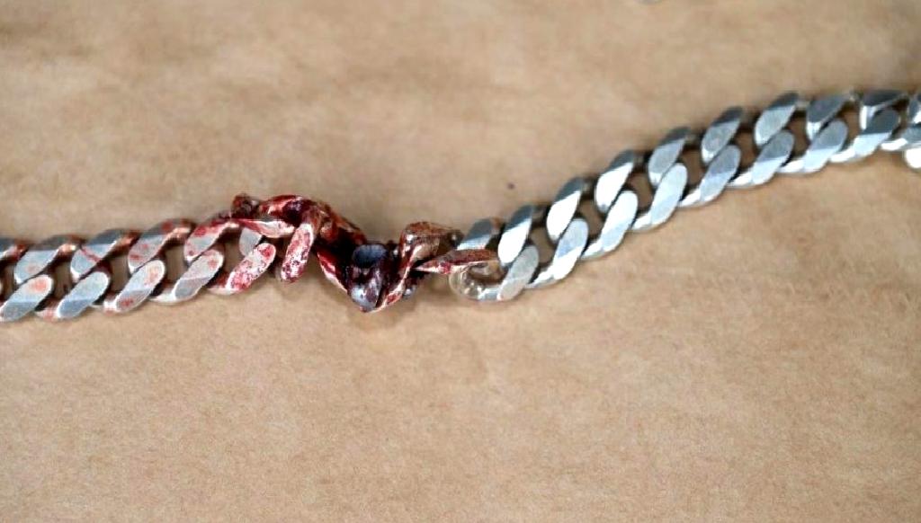 Kurşunun Kolyeye İsabet Etmesi Hayat Kurtardı Kurşunun kolyeye isabet etmesiyle hayat kurtulan bir hikaye. Olayın detayları