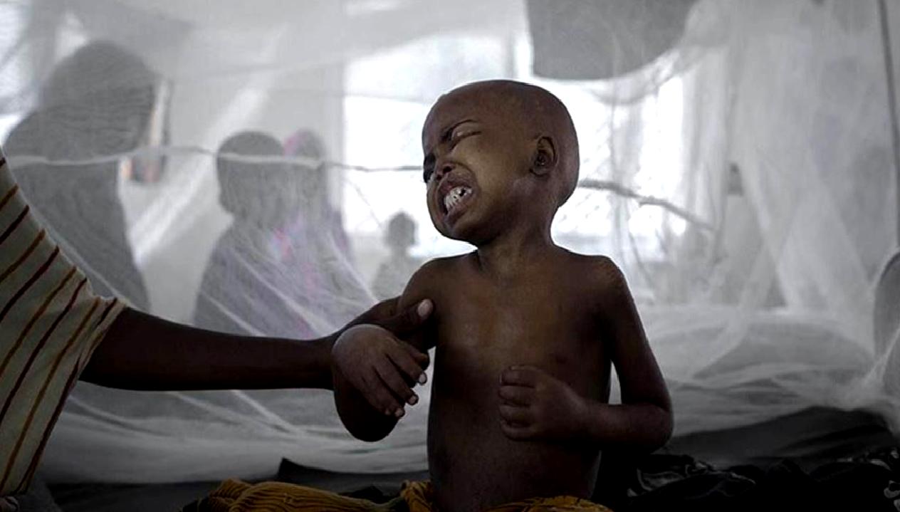 Nijerya'da kolera salgını ile ilgili son durumu ve alınan önlemleri