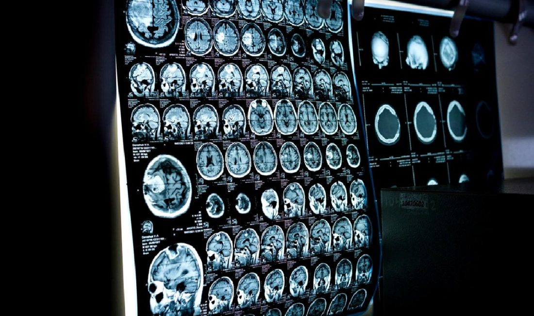 X'in Brezilya'daki faaliyetleri, yerel yasalarla uyum sorunları ve karşılaştığı para