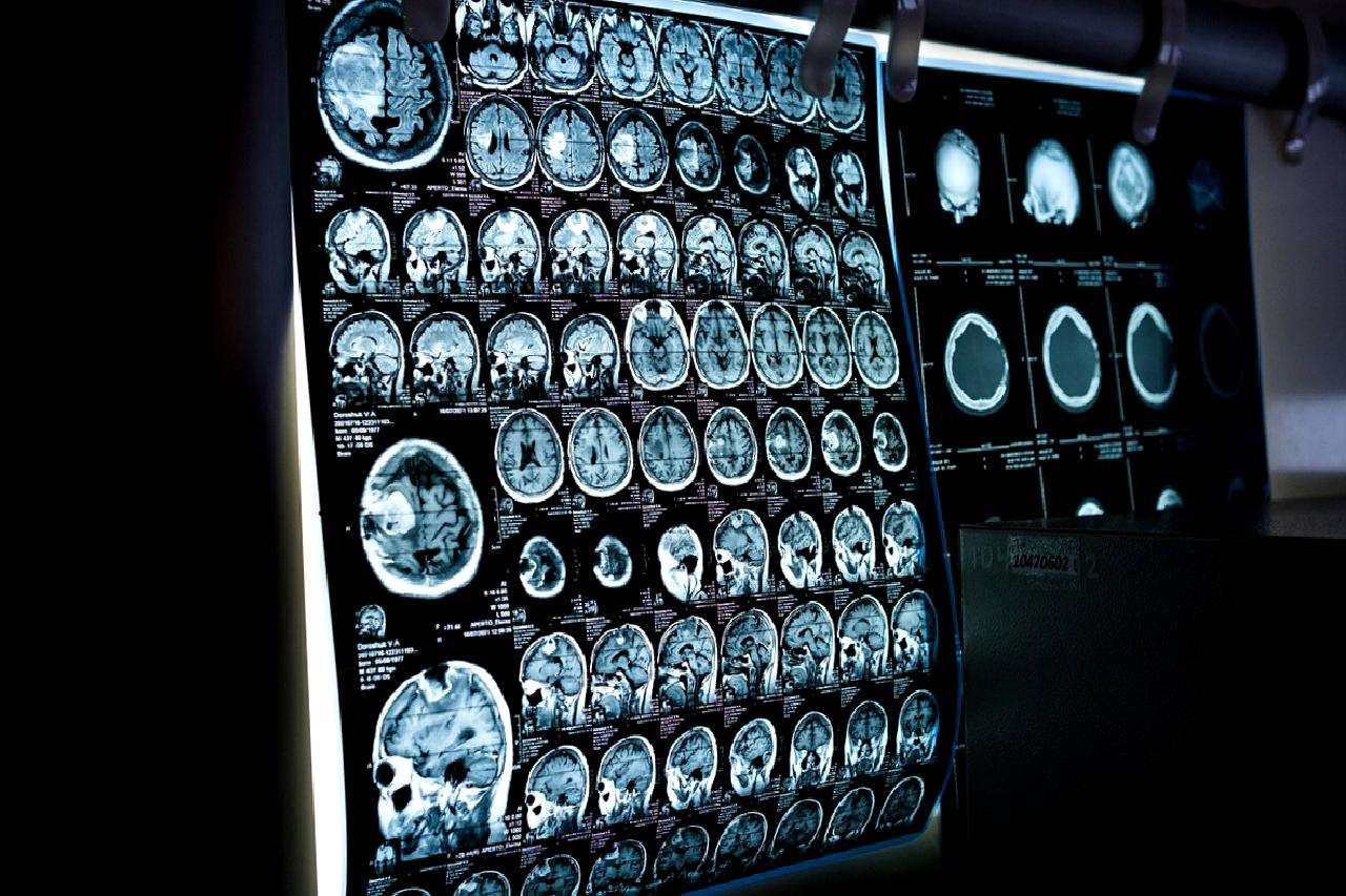 X'in Brezilya'daki faaliyetleri, yerel yasalarla uyum sorunları ve karşılaştığı para