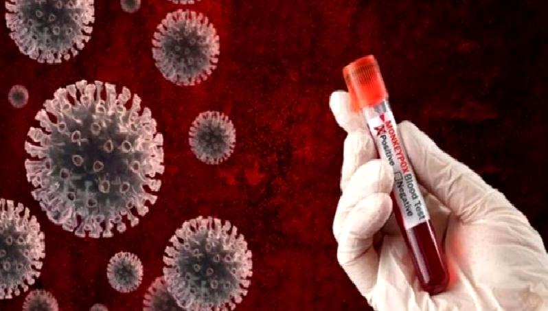 Kosova'da ilk maymun çiçeği vakasının tespiti, sağlık otoritelerini alarma geçirdi.