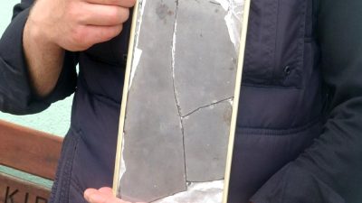 Çankırı'daki Şifa Aynası, yüz felci hastalarına umut sunan yenilikçi tedavi