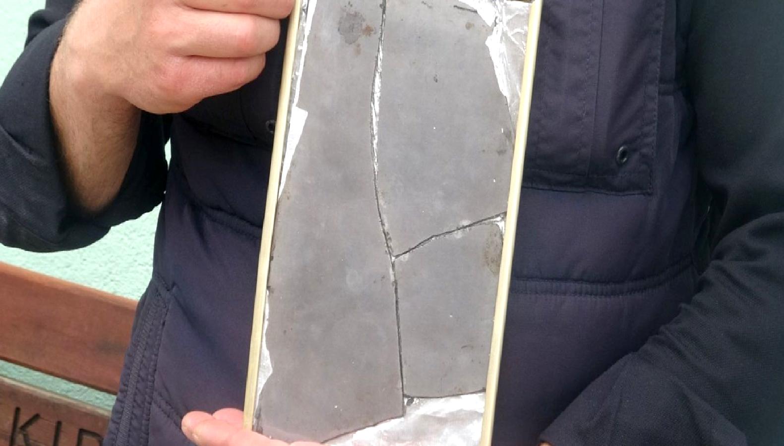 Çankırı'daki Şifa Aynası, yüz felci hastalarına umut sunan yenilikçi tedavi