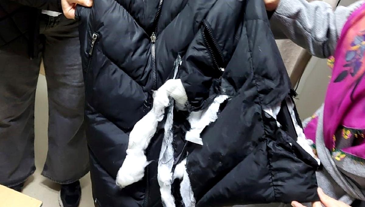 Hasanoğlan'da meydana gelen köpek saldırısında bir kadın yaralandı. Olayla ilgili