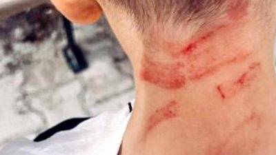 Burdur'daki özel eğitim merkezinde oğluna şiddet iddiası ve yetkililerin tepkisi