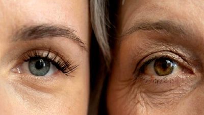 FaceAge araştırmasıyla yüz analizi kullanarak biyolojik yaş tahmininde yeni bir