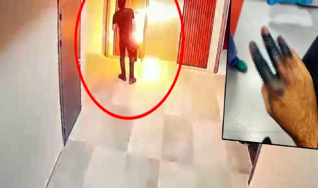 Elektrikli skuter bataryasının elinde patlaması şoku! Detaylar, nedenler ve güvenlik