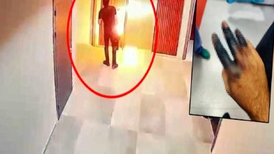 Elektrikli skuter bataryasının elinde patlaması şoku! Detaylar, nedenler ve güvenlik