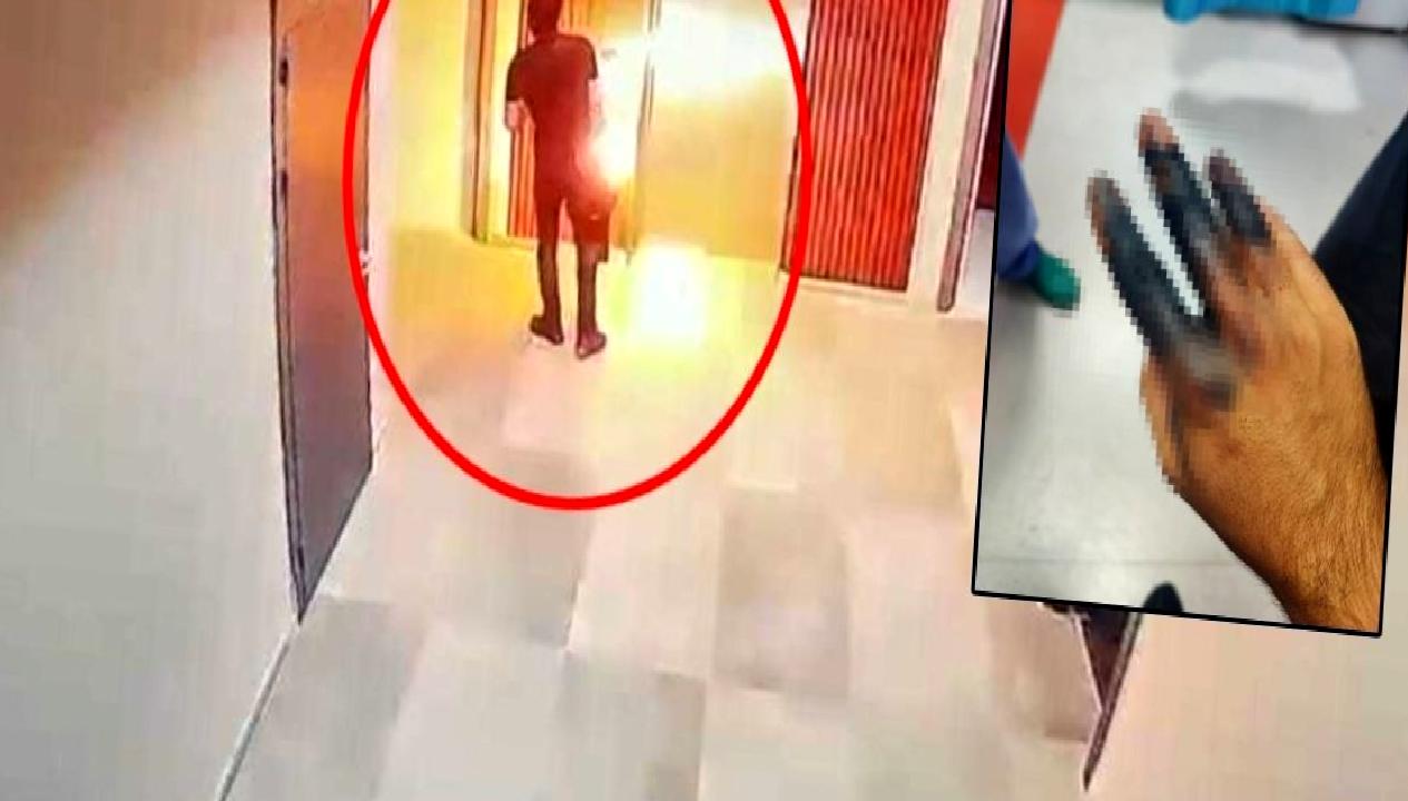 Elektrikli skuter bataryasının elinde patlaması şoku! Detaylar, nedenler ve güvenlik