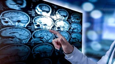 Beynimiz, aynı anıyı her defasında farklı kaydediyor. Hafızanın esnek yapısını